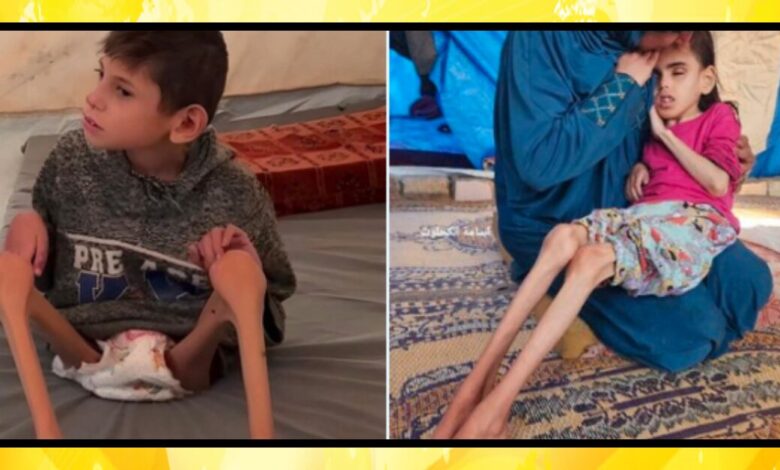 Gaza Starving