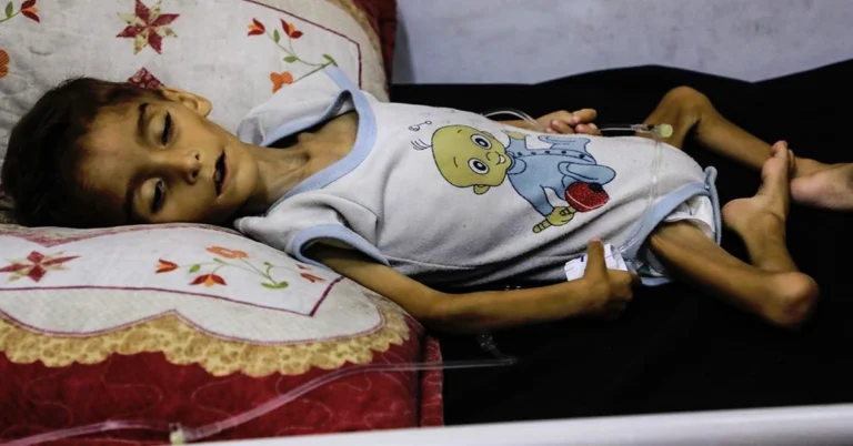 غزہ قحط سالی سے بچے ڈھانچوں میں تبدیل، اسرائیلی کارروائیوں سے لاشوں کے ڈھیر