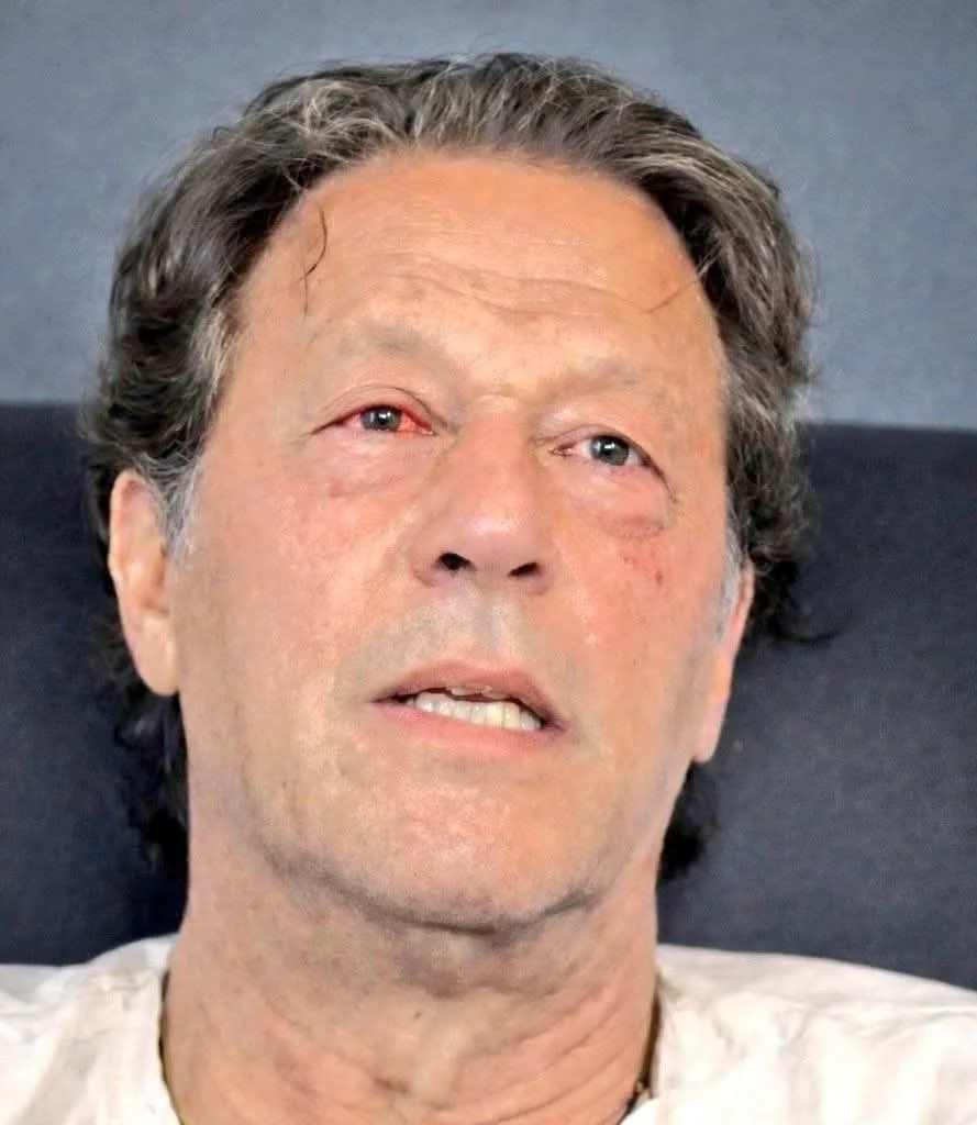 عمران خان کی بینائی