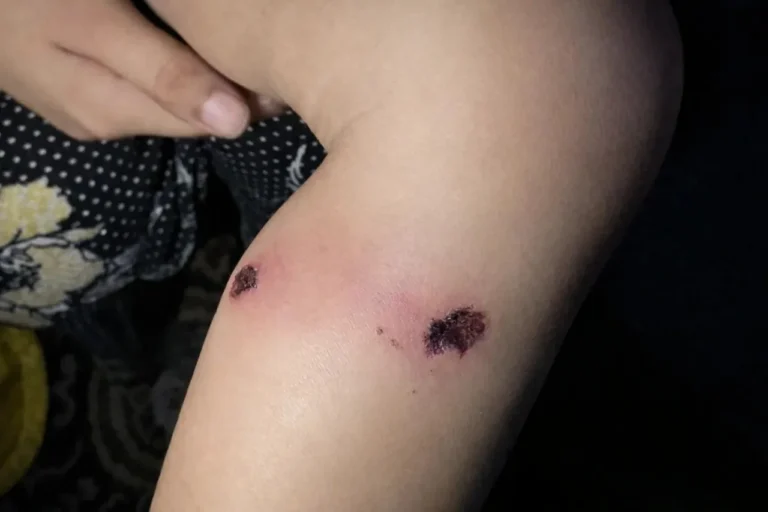 باپ سے اعتراف جرم کروانے کیلئے ایک  سالہ بچے پر  اسرائیلی فورسز کا تشدد