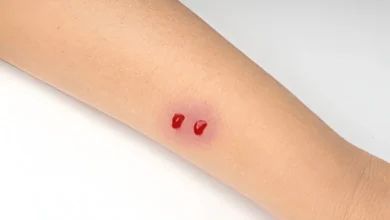 سانپ کے ڈسنے