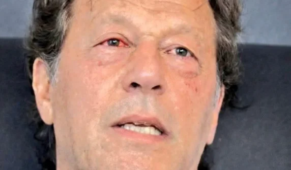 عمران خان کی آنکھ