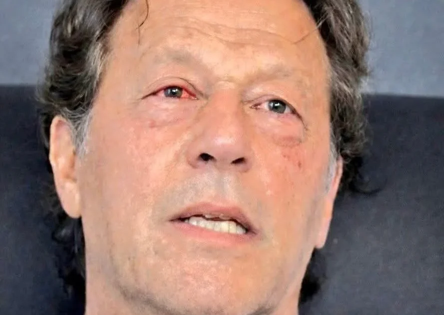 عمران خان کی آنکھ